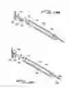 Fig. 09 - Vascular Hole Closure Device
