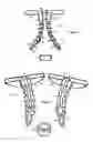 Fig. 02 - Elastic tissue closure with elastic staple