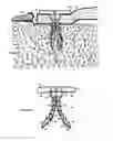 Fig. 06 - Elastic tissue closure with elastic staple