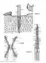Fig. 35 - Elastic tissue closure with elastic staple