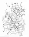 Fig. 02 - Slide-type anti-backout device for prosthesis