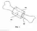 Fig. 02 - Micro-structure particles for load bearing bone growth