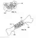 Fig. 07 - Micro-structure particles for load bearing bone growth