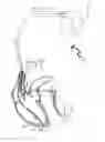 Fig. 01 - IMPLANTABLE PACEMAKER DEVICE THAT USES IMPEDANCE CARDIOGRAPHY