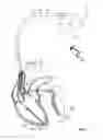 Fig. 02 - IMPLANTABLE PACEMAKER DEVICE THAT USES IMPEDANCE CARDIOGRAPHY