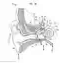 Fig. 02 - BIMODAL HEARING PROSTHESIS