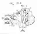 Fig. 03 - BIMODAL HEARING PROSTHESIS