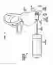 Fig. 08 - BIMODAL HEARING PROSTHESIS