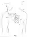 Fig. 02 - Terminating tachyarrhythmias
