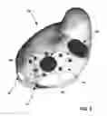 Fig. 04 - Terminating tachyarrhythmias