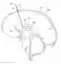Fig. 01 - INTRA-VENTRICULAR BRAIN COOLING CATHETER