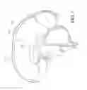 Fig. 06 - INTRA-VENTRICULAR BRAIN COOLING CATHETER