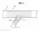 Fig. 02 - CARINA MODIFICATION CATHETER