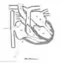 Fig. 02 - Elongated body for deployment in a heart