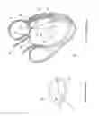 Fig. 03 - Elongated body for deployment in a heart