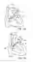 Fig. 30 - Elongated body for deployment in a heart