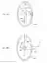 Fig. 40 - Elongated body for deployment in a heart
