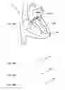 Fig. 43 - Elongated body for deployment in a heart
