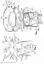 Fig. 02 - Heart valve prosthesis and method of implantation thereof