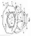 Fig. 03 - Heart valve prosthesis and method of implantation thereof