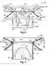Fig. 04 - Heart valve prosthesis and method of implantation thereof