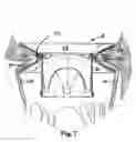 Fig. 06 - Heart valve prosthesis and method of implantation thereof