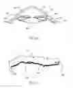 Fig. 02 - REFRACTIVE INTRAOCULAR IMPLANT LENS AND METHOD