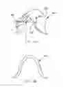 Fig. 07 - REFRACTIVE INTRAOCULAR IMPLANT LENS AND METHOD