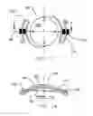 Fig. 09 - REFRACTIVE INTRAOCULAR IMPLANT LENS AND METHOD