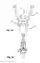 Fig. 03 - Surgical tensioning assembly and methods of use