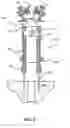 Fig. 06 - Surgical tensioning assembly and methods of use