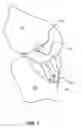 Fig. 08 - Surgical tensioning assembly and methods of use