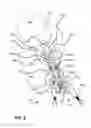 Fig. 09 - Surgical tensioning assembly and methods of use