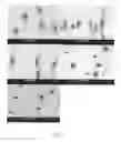 Fig. 09 - Electrochemical coupling of metallic biomaterial implants for biological effect