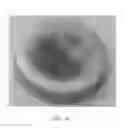 Fig. 37 - Electrochemical coupling of metallic biomaterial implants for biological effect