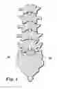 Fig. 02 - Devices and methods for facilitating controlled bone growth or repair