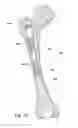 Fig. 07 - Devices and methods for facilitating controlled bone growth or repair