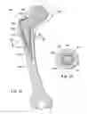 Fig. 08 - Devices and methods for facilitating controlled bone growth or repair