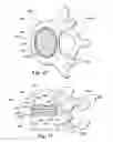 Fig. 09 - Devices and methods for facilitating controlled bone growth or repair