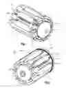 Fig. 02 - Nested expandable sleeve implant