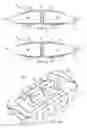 Fig. 03 - FLEXIBLE SPINAL IMPLANT