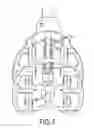 Fig. 06 - LUMBAR JACK IMPLANT