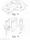 Fig. 06 - Prosthesis with modular extensions
