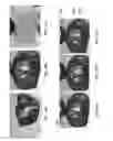 Fig. 28 - Patient-adapted and improved orthopedic implants, designs, and related tools