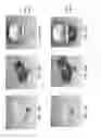 Fig. 33 - Patient-adapted and improved orthopedic implants, designs, and related tools