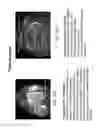Fig. 35 - Patient-adapted and improved orthopedic implants, designs, and related tools