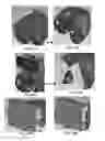 Fig. 40 - Patient-adapted and improved orthopedic implants, designs, and related tools