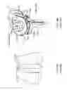 Fig. 05 - Patient-adapted and improved articular implants, designs and related guide tools