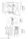 Fig. 08 - Patient-adapted and improved articular implants, designs and related guide tools