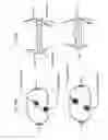 Fig. 100 - Patient-adapted and improved articular implants, designs and related guide tools